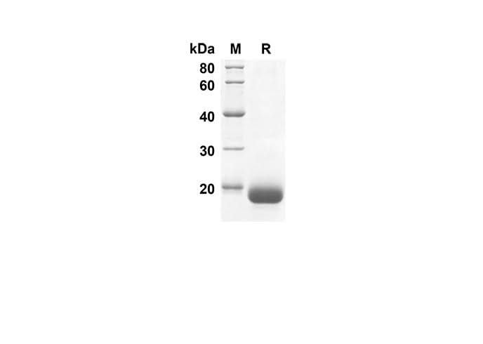 SDS-PAGE analysis of Human DEFB1 proteins, 2 μg/lane of Recombinant Human DEFB1 proteins was resolved with SDS-PAGE under reducing conditions, showing bands at 16.8 kDa.