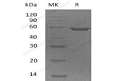 Recombinant Human Ephrin-A5/EFNA5 Protein (Fc Tag) - ABMIUM
