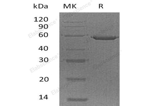 Recombinant Human Ephrin-A5/EFNA5 Protein (Fc Tag) - ABMIUM