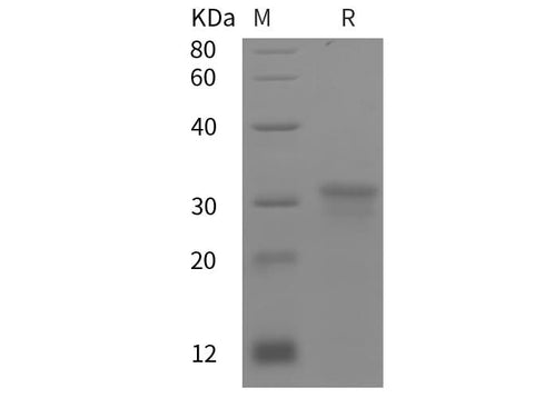 SDS-PAGE analysis of Human SMOC2 proteins, 2 μg/lane of Recombinant Human SMOC2 proteins was resolved with SDS-PAGE under reducing conditions, showing bands at 32 kDa.