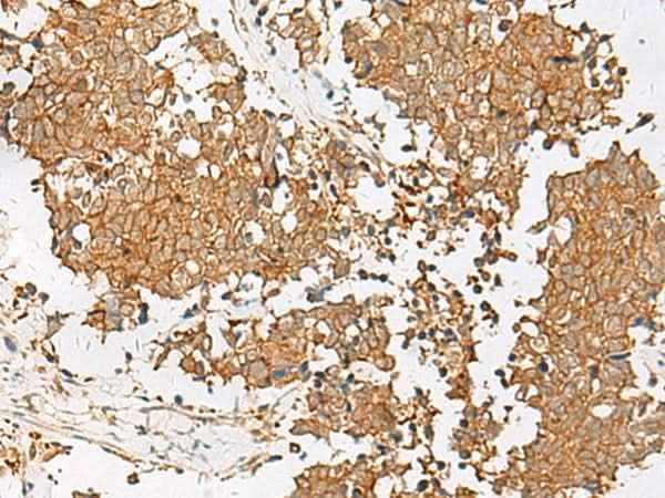 Anti-Human GSTM2 Antibody