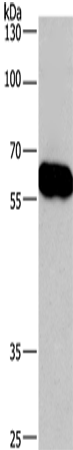 Anti-Human/Mouse CORO1C Antibody - ABMIUM