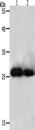 Anti-Human PRDX3 Antibody - ABMIUM