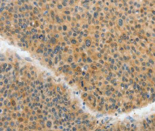 Anti-Human/Mouse/Rat ACLY Antibody