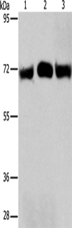 Anti-Human/Mouse/Rat RPN1 Antibody - ABMIUM