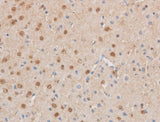 Immunohistochemistry of paraffin-embedded Mouse brain using MAP2K6 Polyclonal Antibody at dilution of 1:50