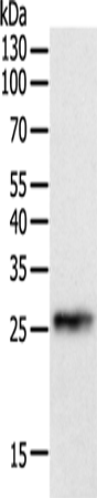Anti-Human CRP Antibody - ABMIUM