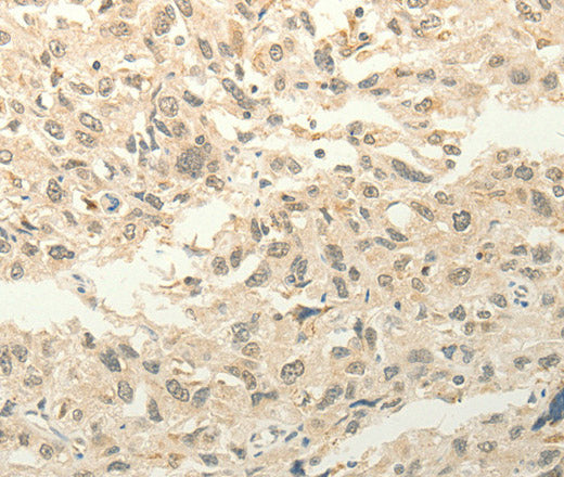Anti-Human/Mouse/Rat FZD8 Antibody - ABMIUM