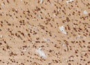Anti-Human TLR2 Antibody [A939] - ABMIUM