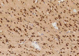Anti-Human TLR2 Antibody [A939] - ABMIUM