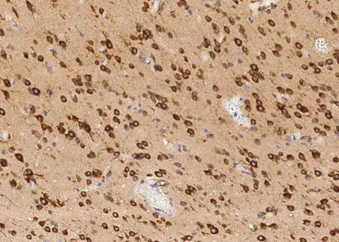 Anti-Human TLR2 Antibody [A939] - ABMIUM