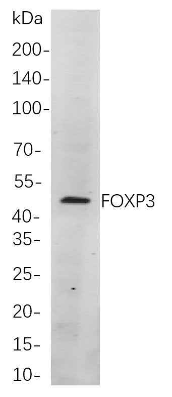 Anti-Human/Mouse FOXP3 Antibody [B774] - ABMIUM