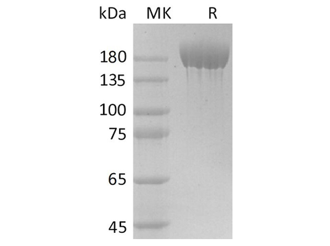 Recombinant SARS-CoV-2 S-trimer Protein (His Tag) - ABMIUM