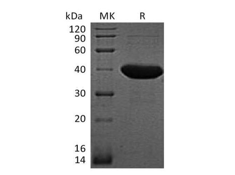 SDS-PAGE analysis of E.coli Lactose Operon Repressor/LacI proteins, 2 μg/lane of Recombinant E.coli Lactose Operon Repressor/LacI proteins was resolved with SDS-PAGE under reducing conditions, showing bands at 40 kDa.