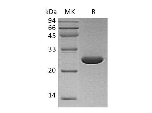 Recombinant Human UCHL3/UCH-L3 Protein (His Tag) - ABMIUM