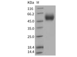 Recombinant Human IL17RD Protein (His Tag) - ABMIUM