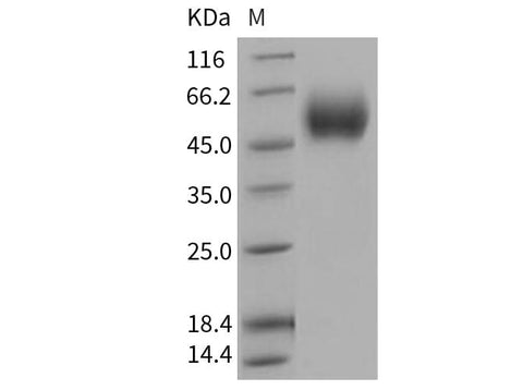 Recombinant Human IL17RD Protein (His Tag) - ABMIUM