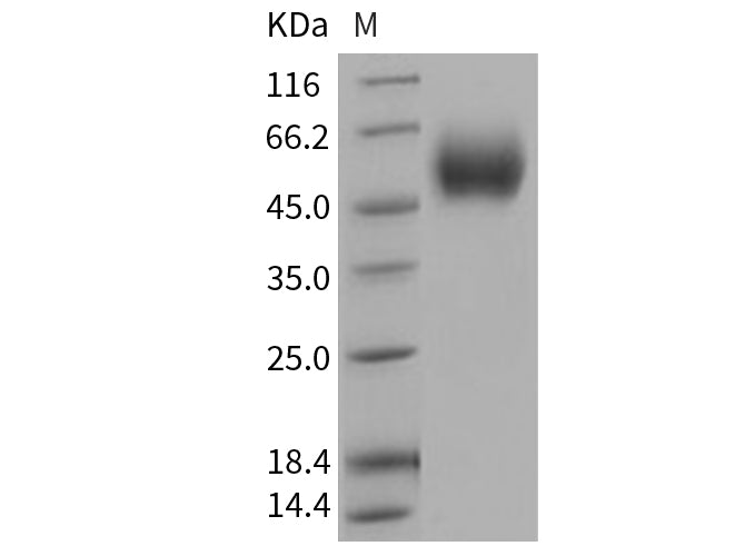 Recombinant Human IL17RD Protein (His Tag) - ABMIUM