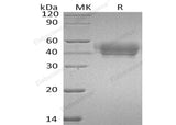 Recombinant Human SerpinA5/SERPINA5 Protein (His Tag) - ABMIUM