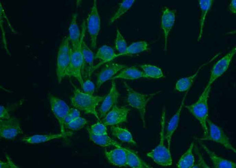 Anti-Human CD44 Antibody [A1149] - ABMIUM