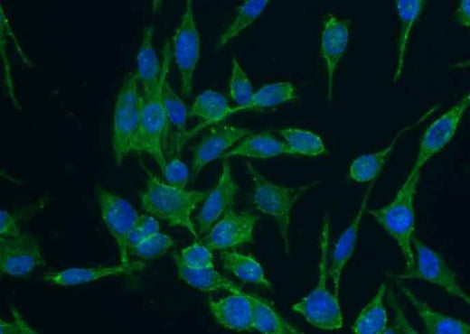Anti-Human CD44 Antibody [A1149] - ABMIUM