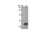 SDS-PAGE analysis of Mouse IL-28B/IFN-lambda-3 proteins, 2 μg/lane of Recombinant Mouse IL-28B/IFN-lambda-3 proteins was resolved with SDS-PAGE under reducing conditions, showing bands at 25 kDa.