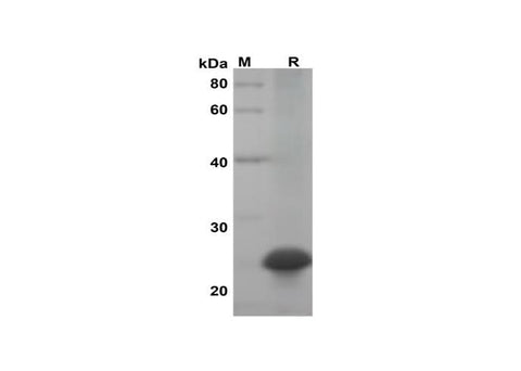 SDS-PAGE analysis of Mouse IL-28B/IFN-lambda-3 proteins, 2 μg/lane of Recombinant Mouse IL-28B/IFN-lambda-3 proteins was resolved with SDS-PAGE under reducing conditions, showing bands at 25 kDa.