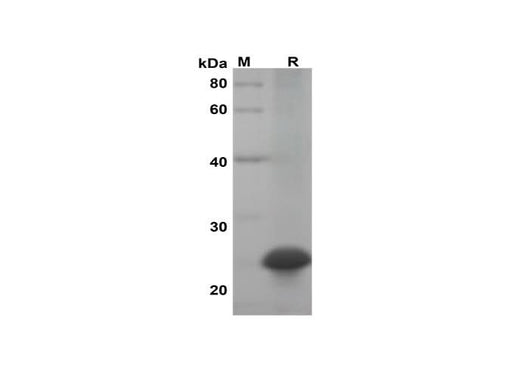 SDS-PAGE analysis of Mouse IL-28B/IFN-lambda-3 proteins, 2 μg/lane of Recombinant Mouse IL-28B/IFN-lambda-3 proteins was resolved with SDS-PAGE under reducing conditions, showing bands at 25 kDa.