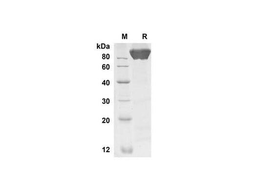 SDS-PAGE analysis of Human SELE proteins, 2 μg/lane of Recombinant Human SELE proteins was resolved with SDS-PAGE under reducing conditions, showing bands at 61 kDa.