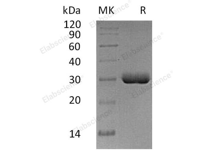Recombinant Human Butyrophilin 3A2/BTN3A2 Protein (His Tag) - ABMIUM