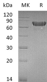 Recombinant Mouse OX40/TNFRSF4 Protein (Fc Tag) - ABMIUM