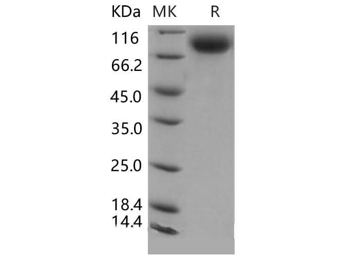 Recombinant Mouse E-Selectin/SELE Protein (His Tag) - ABMIUM