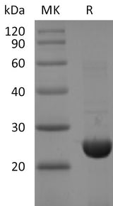 Recombinant SARS-CoV-2 NSP8 Protein (His Tag) - ABMIUM