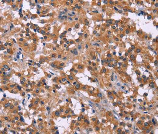 Anti-Human/Mouse/Rat PIP5K1B Antibody