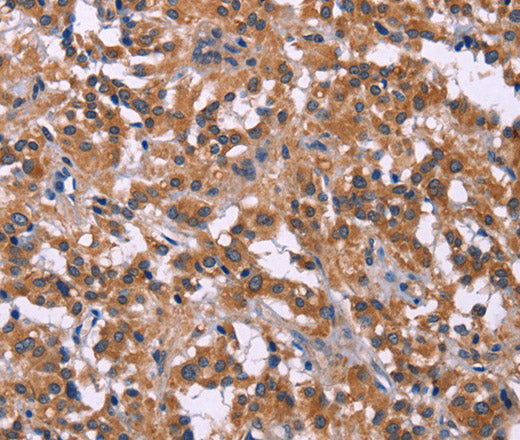 Anti-Human/Mouse/Rat PIP5K1B Antibody - ABMIUM
