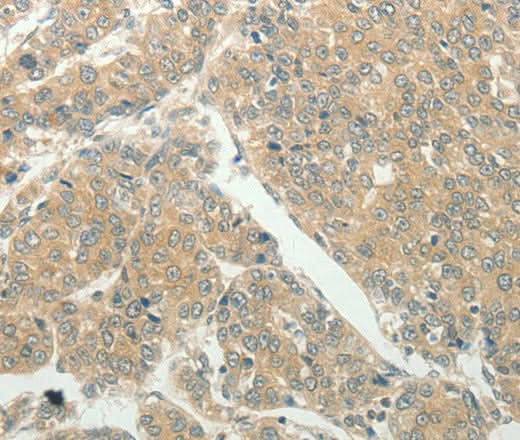 Anti-Human SLC8A3 Antibody - ABMIUM