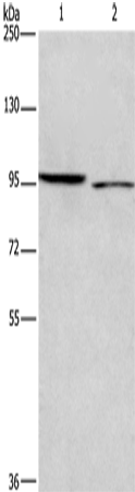 Anti-Human/Mouse ICAM5 Antibody - ABMIUM