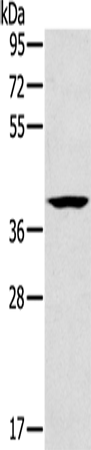 Anti-Human/Mouse CAB39 Antibody - ABMIUM