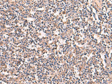 Immunohistochemistry of paraffin-embedded Human tonsil tissue using RIOK1 Polyclonal Antibody at dilution of 1:60(×200)