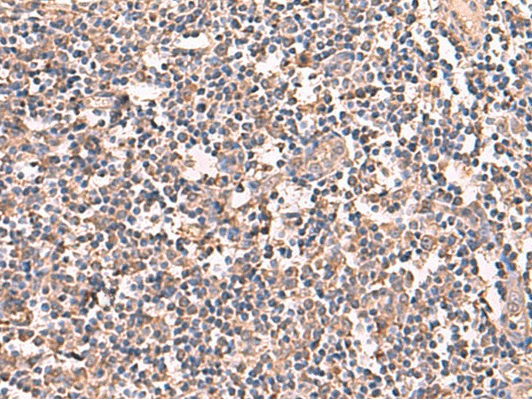 Immunohistochemistry of paraffin-embedded Human tonsil tissue using RIOK1 Polyclonal Antibody at dilution of 1:60(×200)