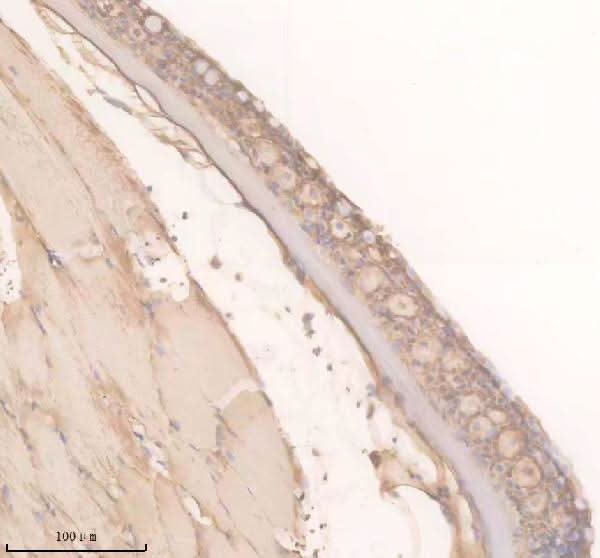 Anti-Zebrafish TRPM2 Antibody Boster Bio