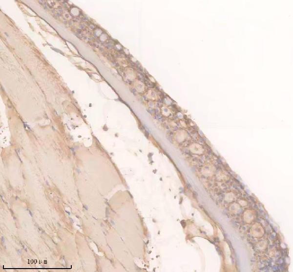 Anti-Zebrafish TRPM2 Antibody Boster Bio