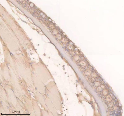Anti-Zebrafish TRPM2 Antibody Boster Bio