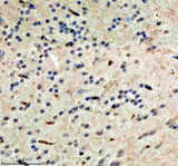 Anti-Zebrafish HDAC1 Antibody Boster Bio