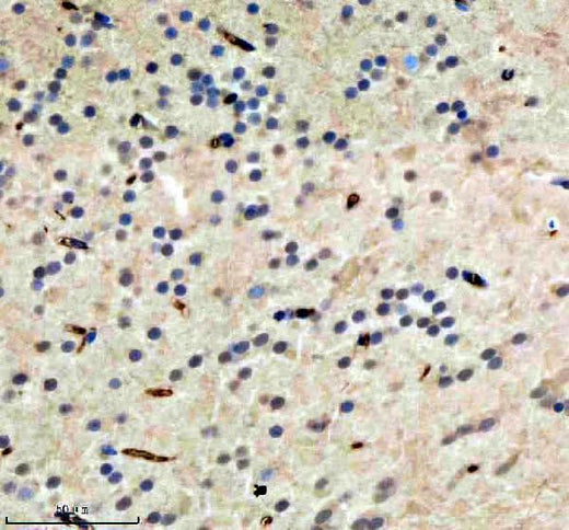 Anti-Zebrafish HDAC1 Antibody Boster Bio