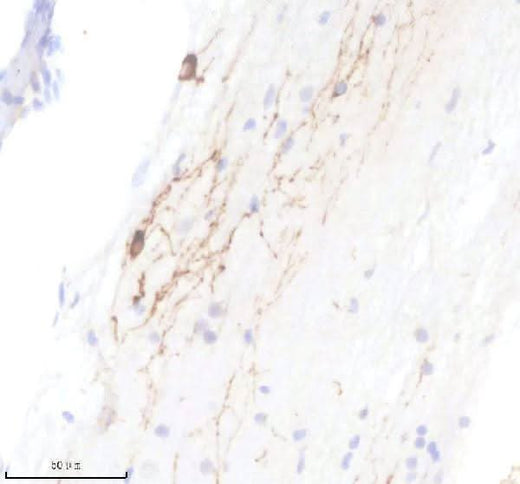 Anti-Zebrafish TPH2 Antibody Boster Bio