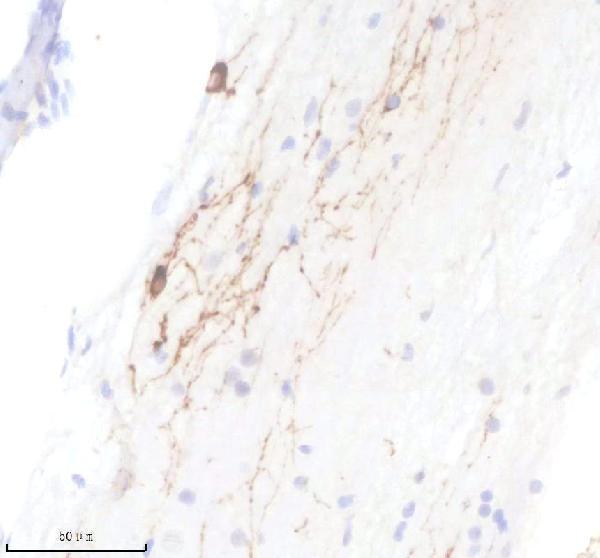 Anti-Zebrafish TPH2 Antibody Boster Bio