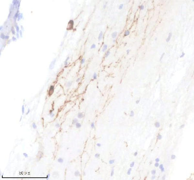 Anti-Zebrafish TPH2 Antibody Boster Bio