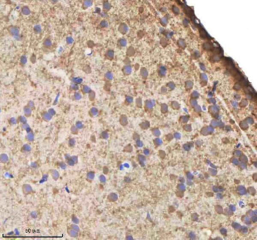 Anti-Zebrafish IL-1 beta/IL1B Antibody Boster Bio
