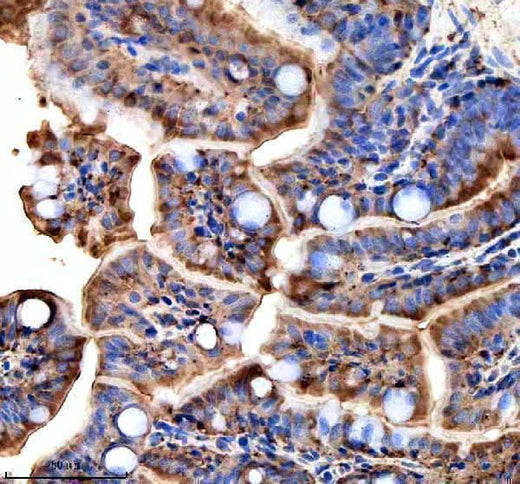 Anti-Zebrafish TTC7B Antibody Boster Bio